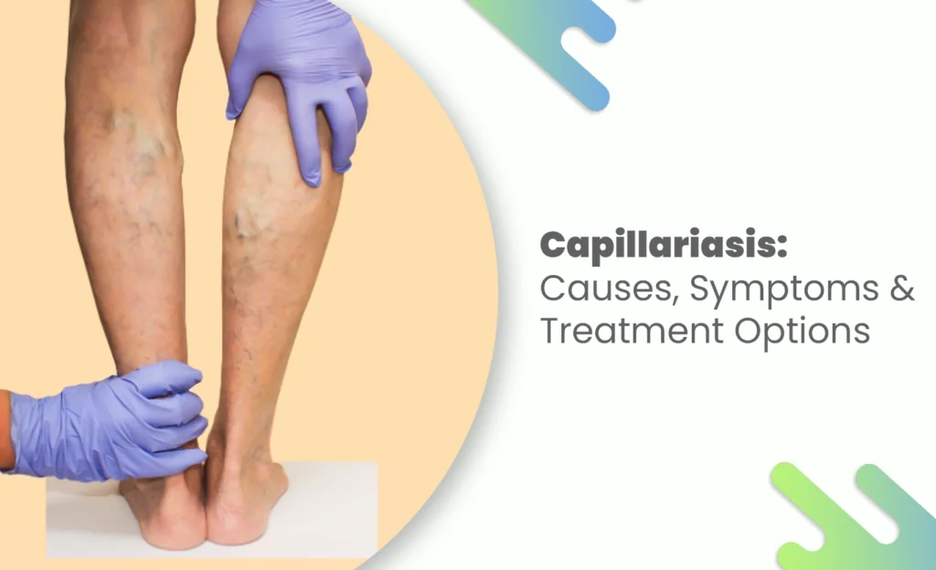 Doctor examining swollen lower legs for capillariasis symptoms during medical checkup
