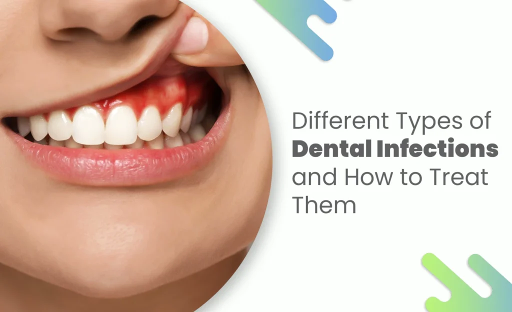 Gum redness caused by a dental infection