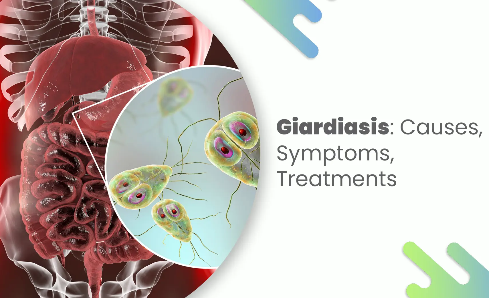 Giardiasis infection illustration