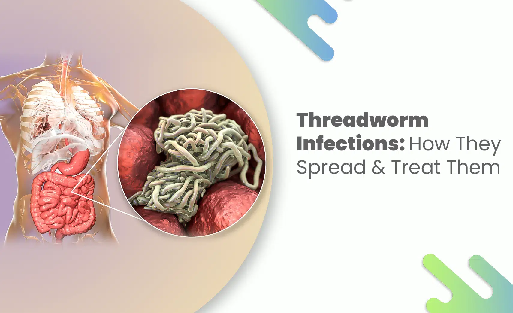 Threadworm infection inside human intestines illustration