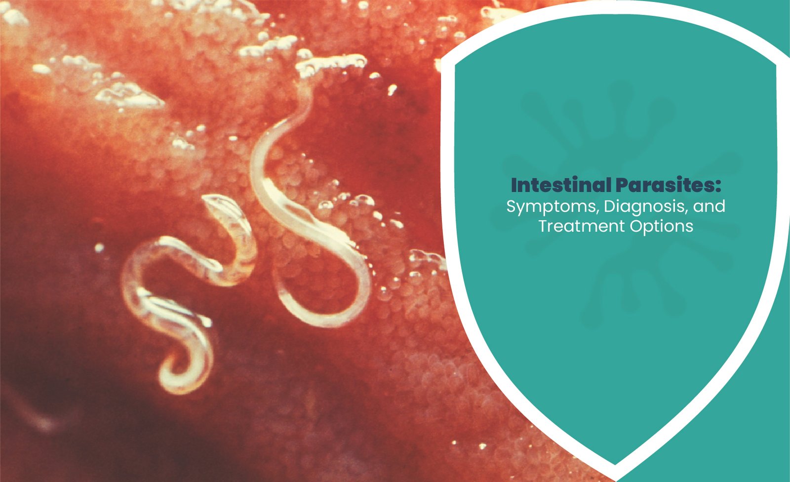 Intestinal parasites treatment illustration showing parasitic worms inside the digestive tract