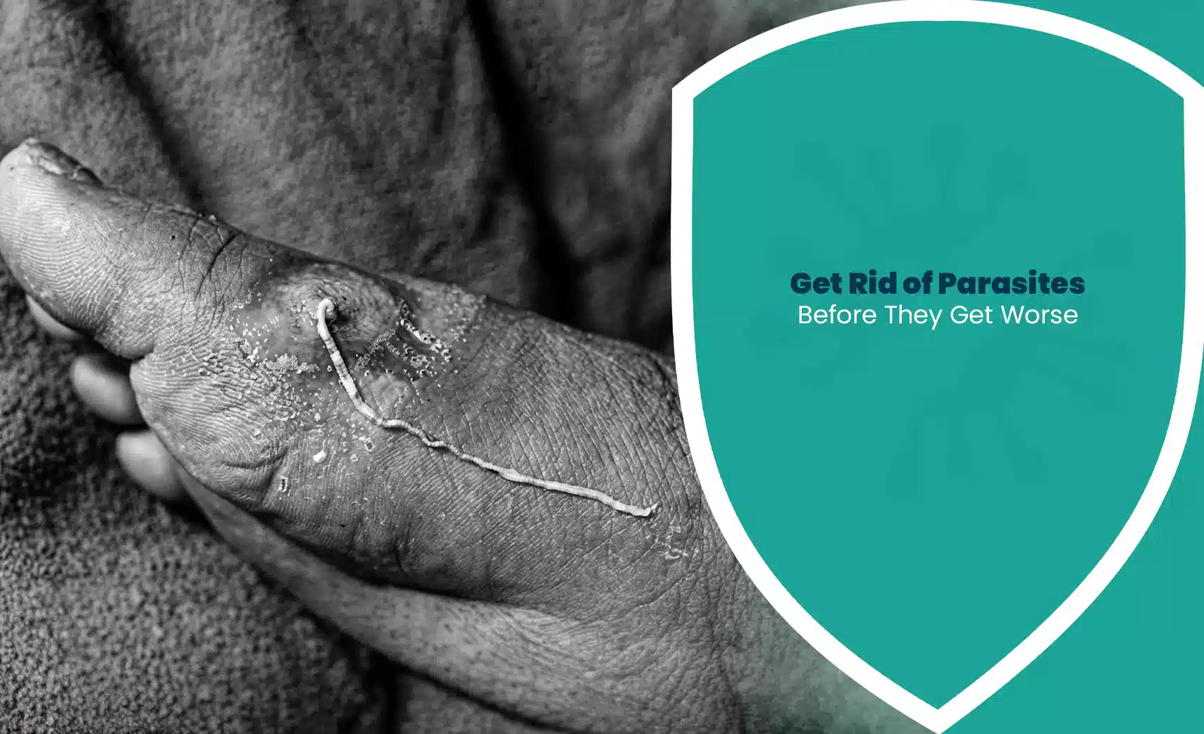 Get rid of parasites concept showing parasitic worm infection on human foot with warning health message