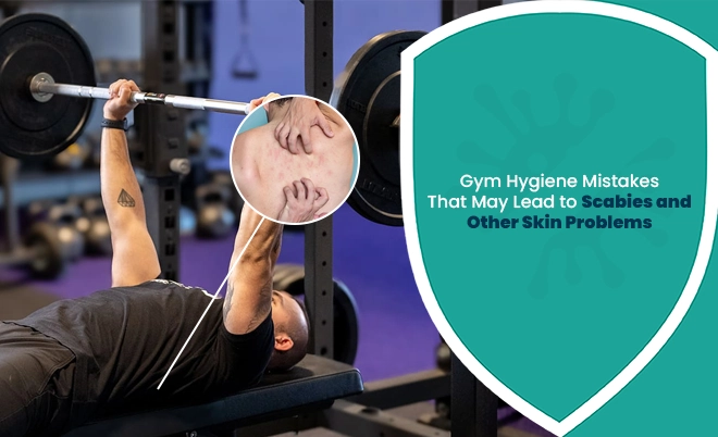 Gym hygiene mistakes during workout that may cause scabies and other skin infections in shared gym equipment