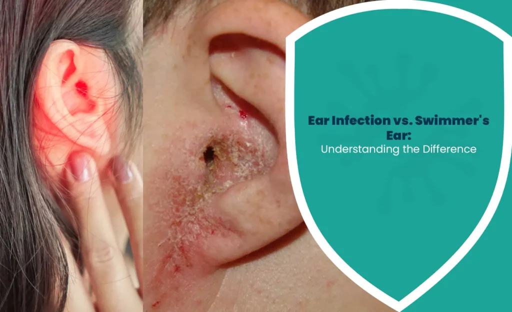 Ear Infection and Swimmer's Ear showing painful, irritated ear and outer ear inflammation