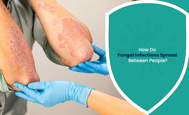 How do fungal infections spread between people through direct skin contact?