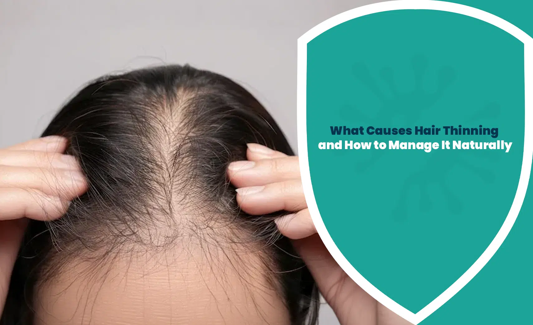 Hair thinning shown through a widening scalp part and reduced hair density