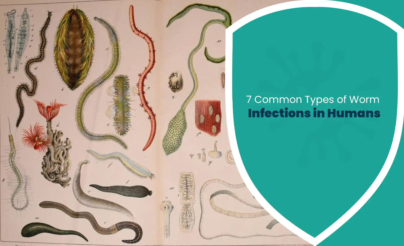 7 common types of worm infections in humans shown in a medical illustration