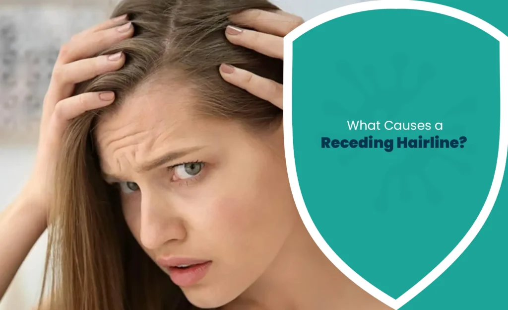 Receding hairline in a woman showing visible hairline recession and thinning